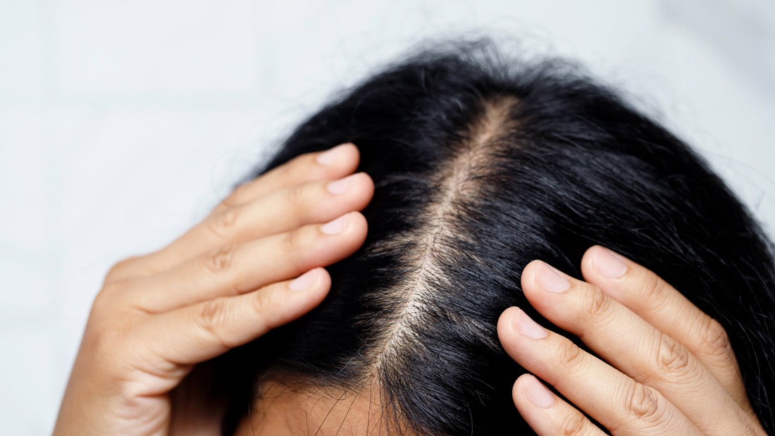🧊 Mentolo: il re della freschezza per il tuo cuoio capelluto